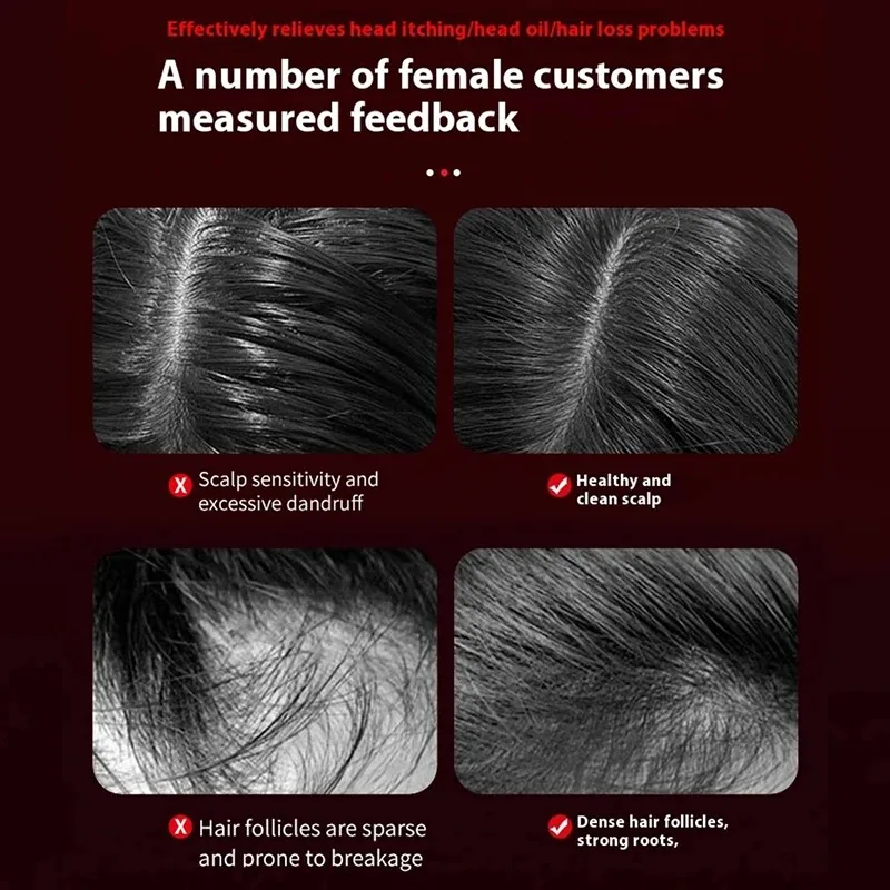 Electric Vibration Massage Com - Hair Care Growth ulasan dan harga