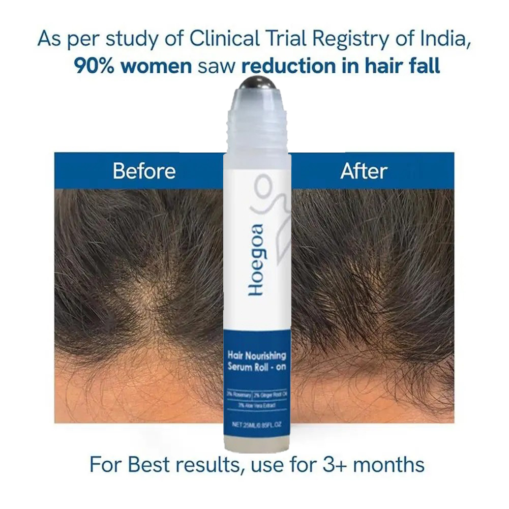 25ml 3% Rosemary Hair Growth S - Hair Care Essence Oil ulasan dan harga