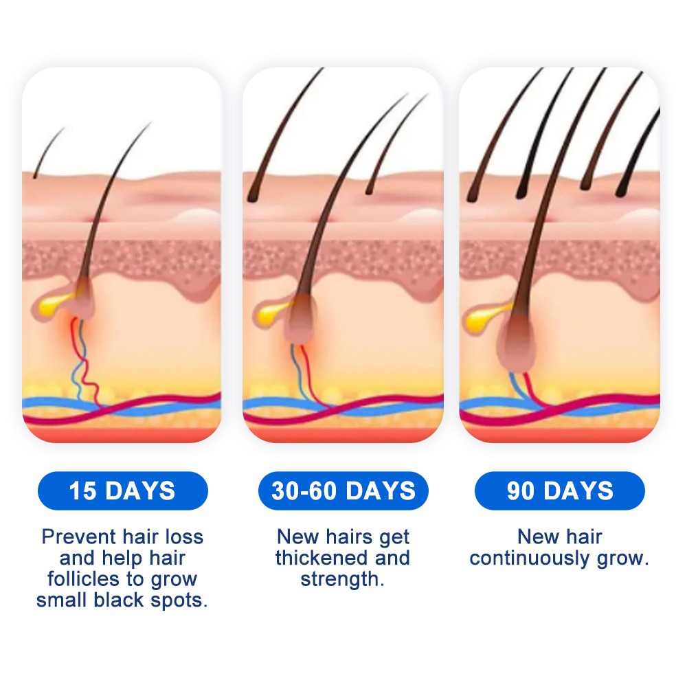 Alopecia Hair Growth Spray Sop - Hair Care Growth ulasan dan harga