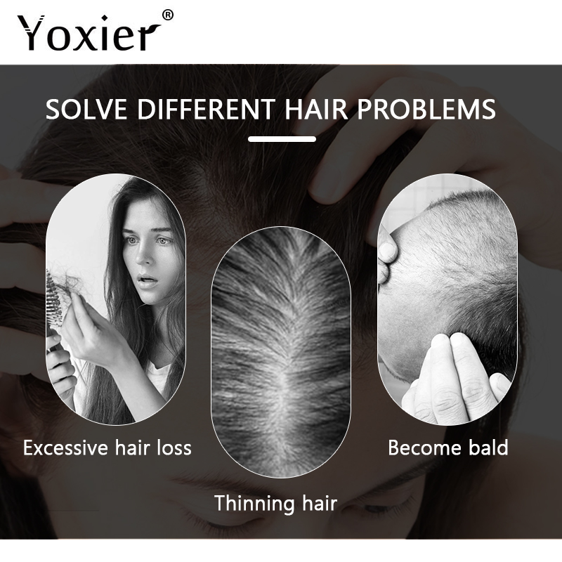 Intensive Growth Serum Prevent - Hair Care Growth ulasan dan harga