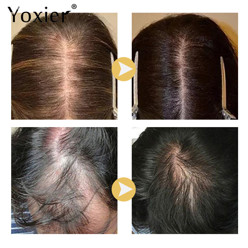 Intensive Growth Serum Prevent - Hair Care Growth ulasan dan harga