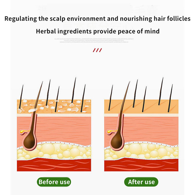 Sophora Flavescens Hair Follic - Hair Care Cream ulasan dan harga