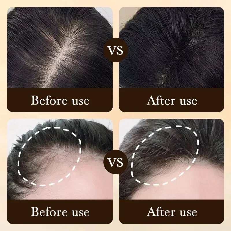 Biotin Fast Hair Growth Oil Pr - Hair Care Essence Oil ulasan dan harga