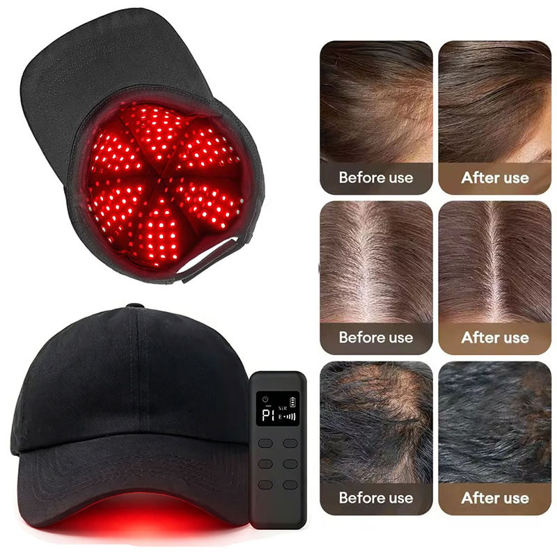 660nm 940nm Light 142 Groups / - Hair Care Wella ulasan dan harga