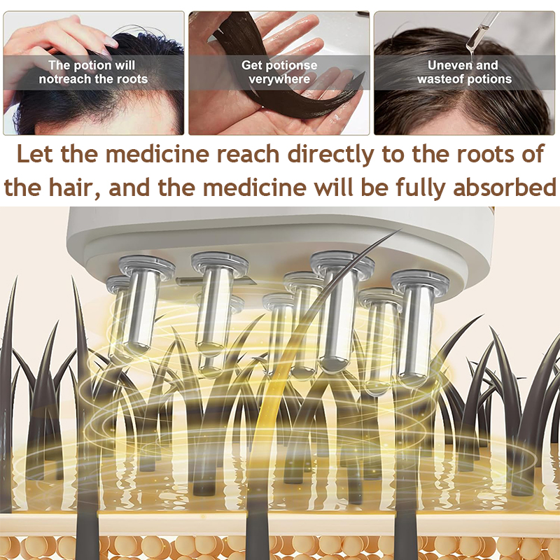 Electric Vibration Scalp Essen - Hair Care Essence Oil ulasan dan harga