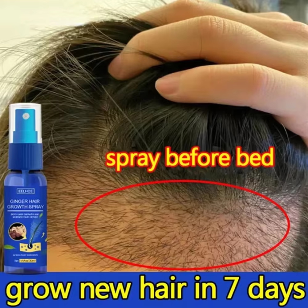 Fast Ginger Hair Growth Spray  - Hair Care For Men ulasan dan harga