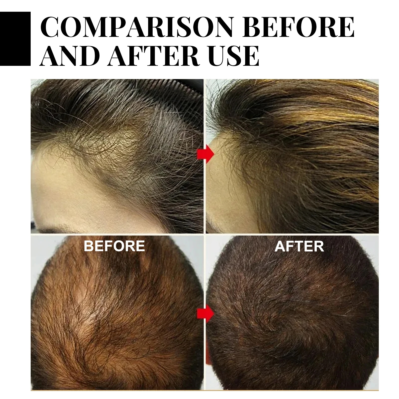 Fast Ginger Hair Growth Spray  - Hair Care For Men ulasan dan harga