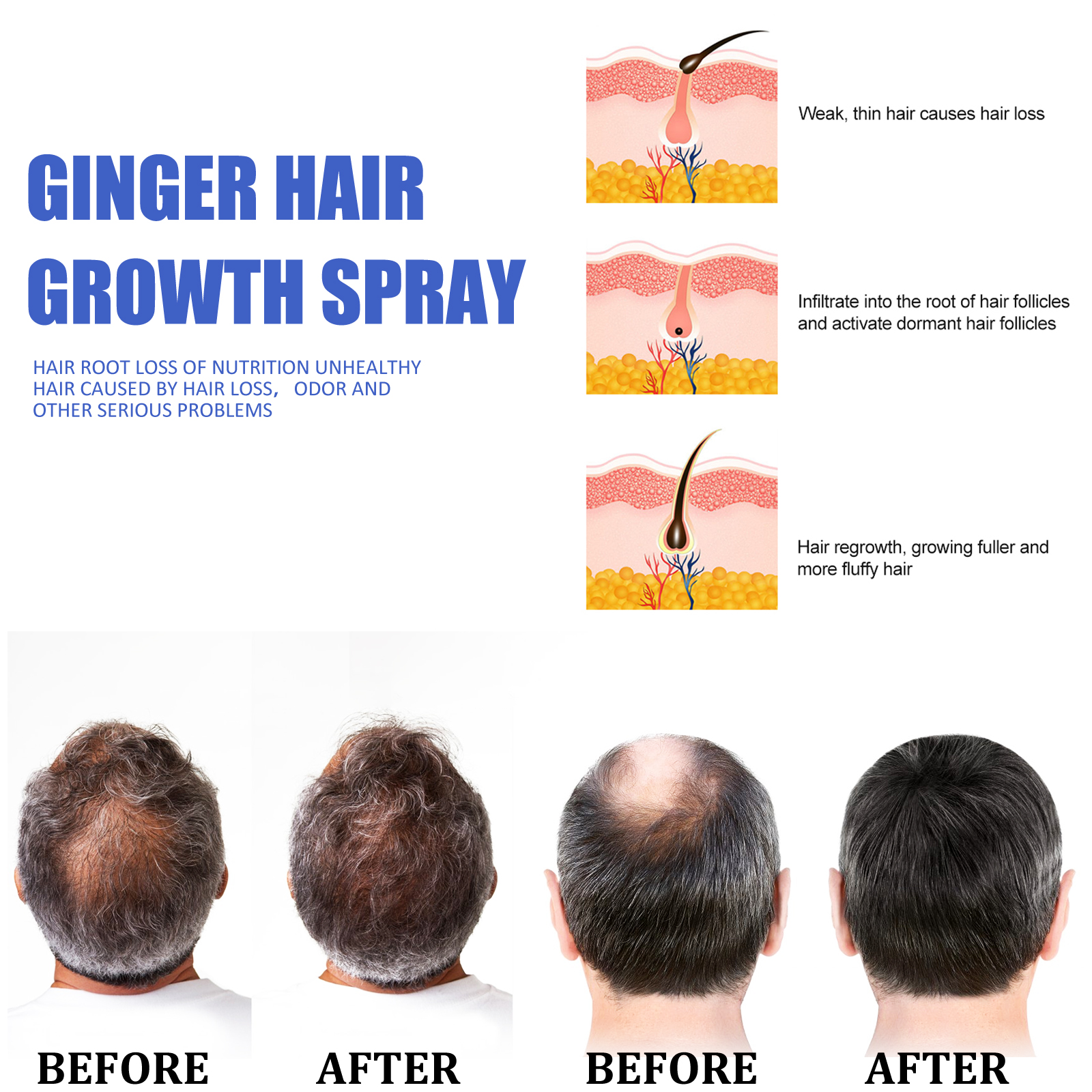 Fast Ginger Hair Growth Spray  - Hair Care For Men ulasan dan harga