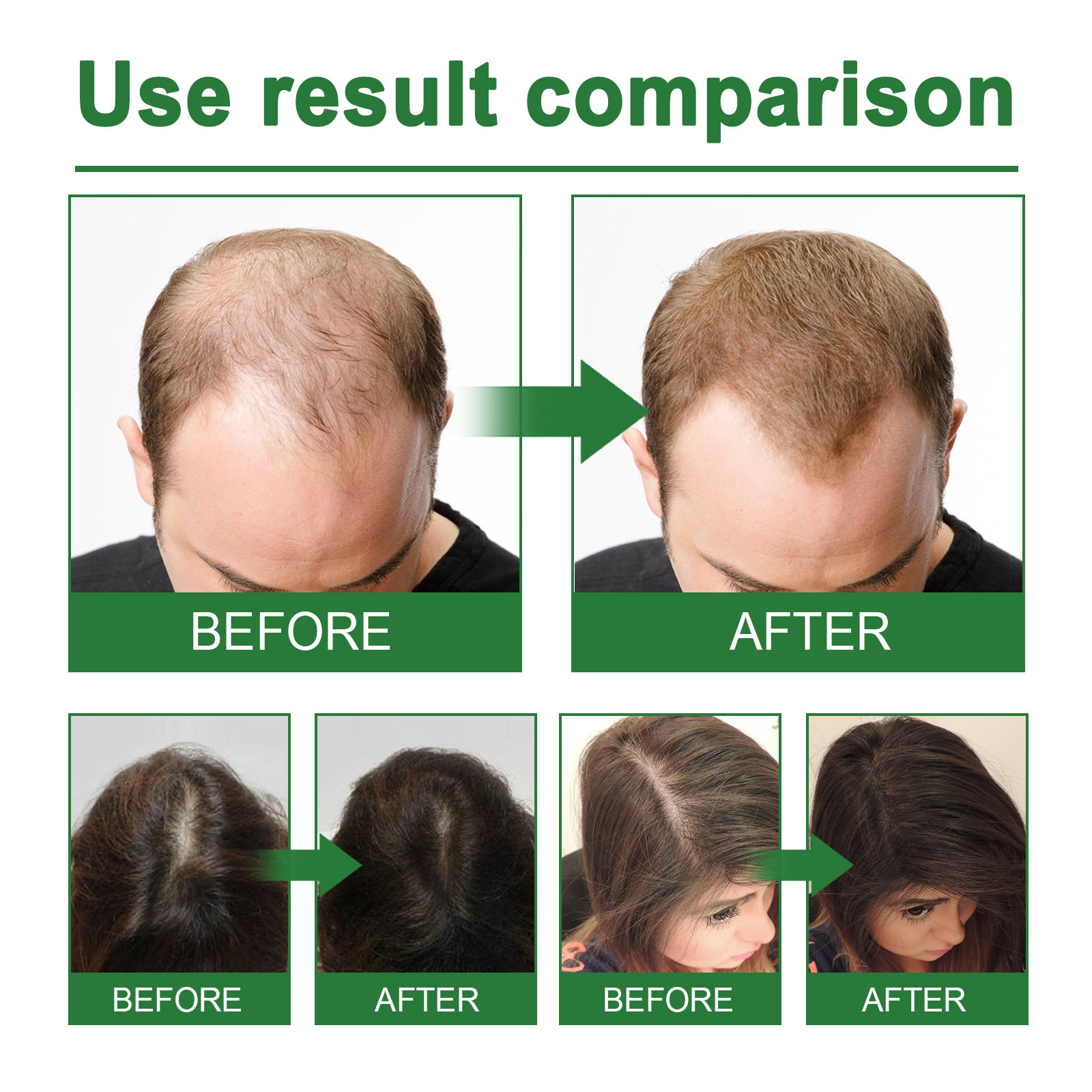 Rosemary Spray for Hair Nouris - Hair Care Growth ulasan dan harga