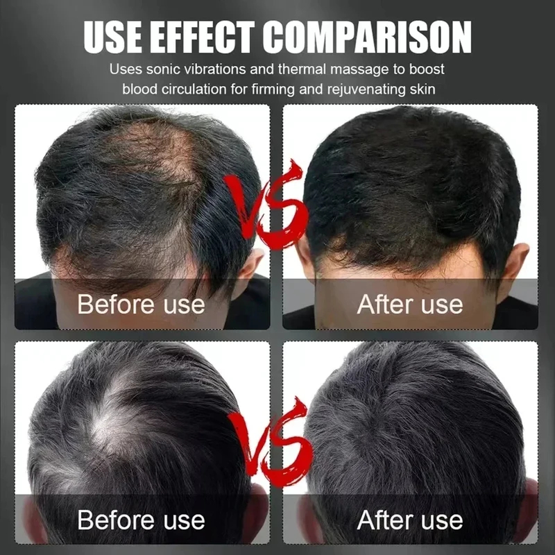 660nm 850nm Red Light Infrared - Hair Care Growth ulasan dan harga